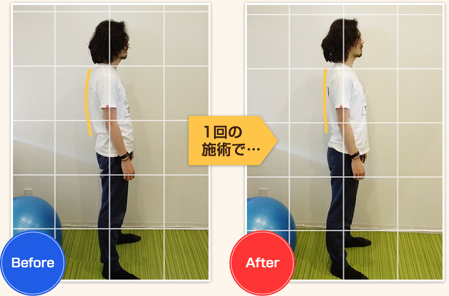 ビフォアーアフター